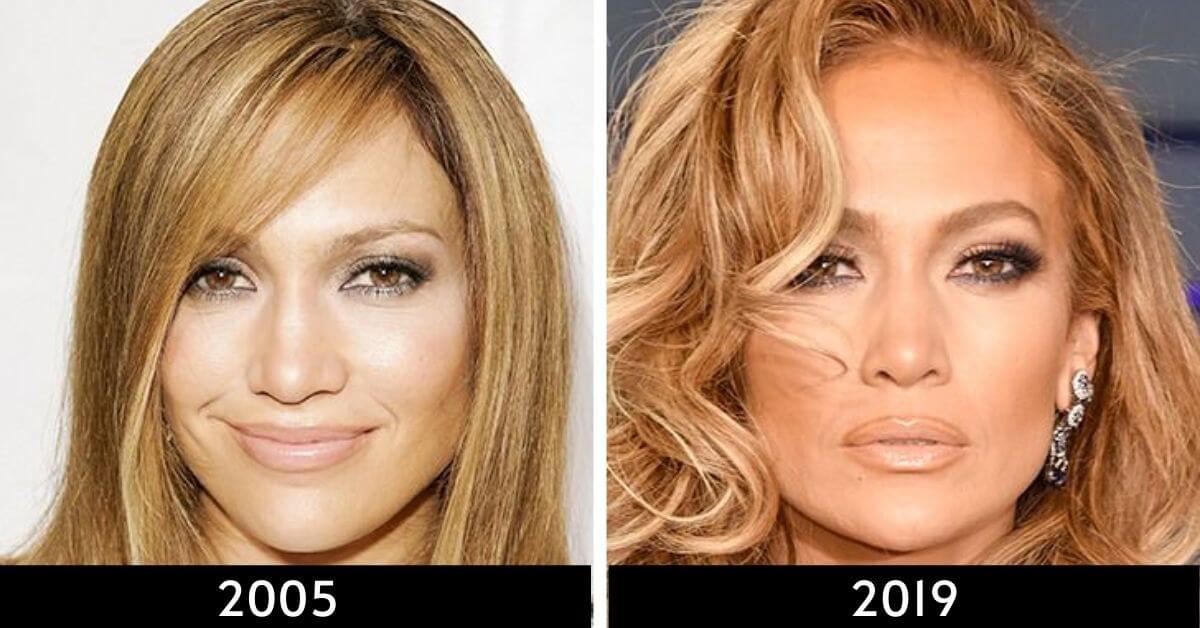 Yaşlanmayı Durduran Ünlüler Jennifer Lopez